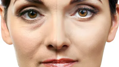 Before-After-Eye-Brightening-Stock-Photo.webp