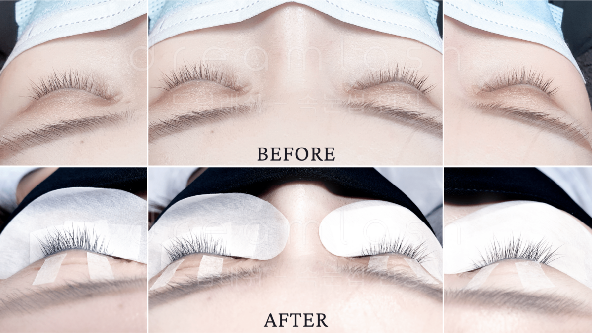 Nano-Eyelash-Regrowth-Before-After-1200x675.png